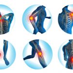 physiotherapy